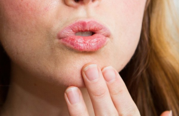Don’t Ignore These Dry Lips And Mouth Symptoms!