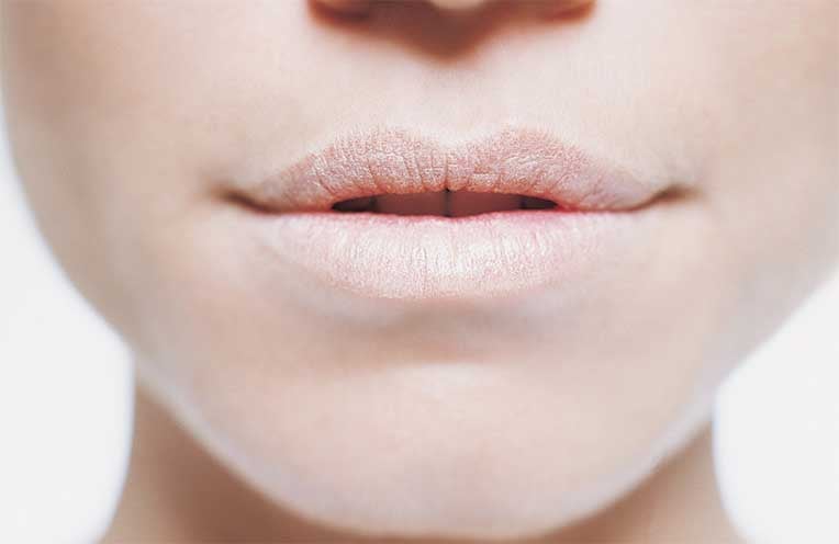 Dont Ignore These Dry Lips And Mouth Symptoms 