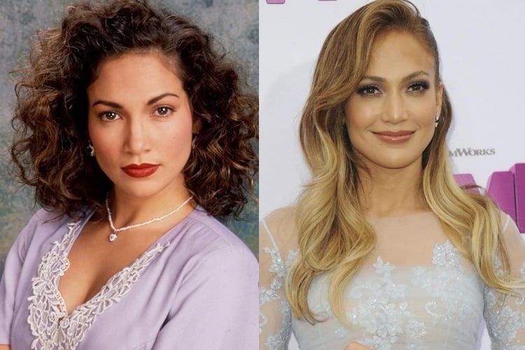 Hollywood Stars Before And After Plastic Surgery