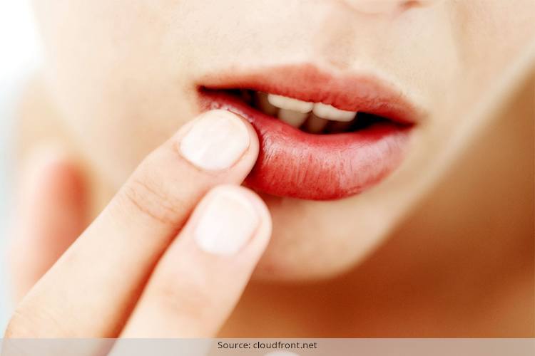 Home Remedies For Chapped Lips