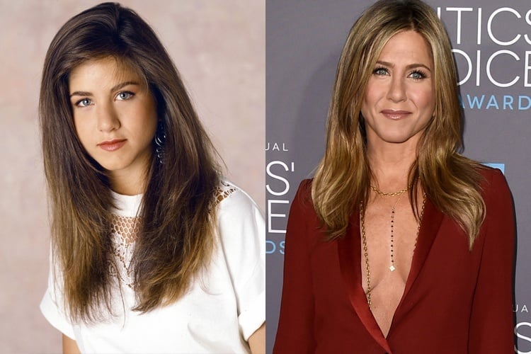 Jennifer Aniston before and after plastic surgery