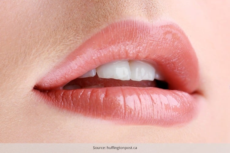 treatment for chapped lips