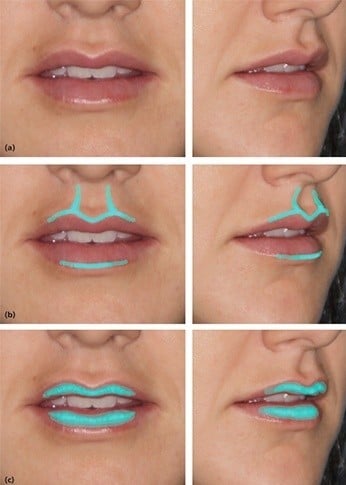 How To Contour Thin Upper Lips
