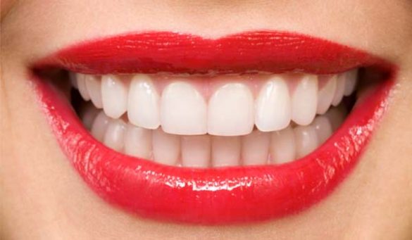 How to Whiten Your Teeth