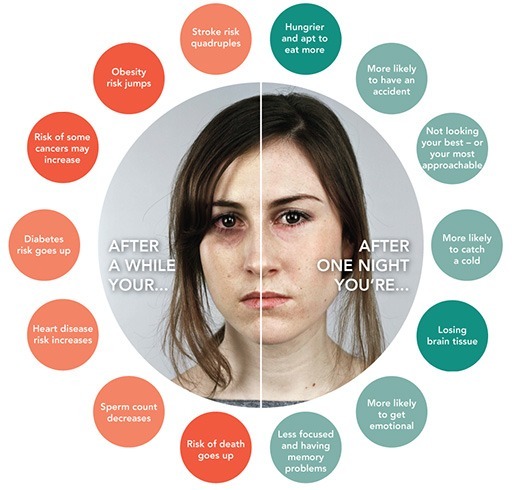 Beauty Benefits of Sleep for Skin
