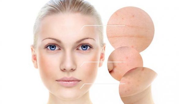 Salicylic Acid Face Wash