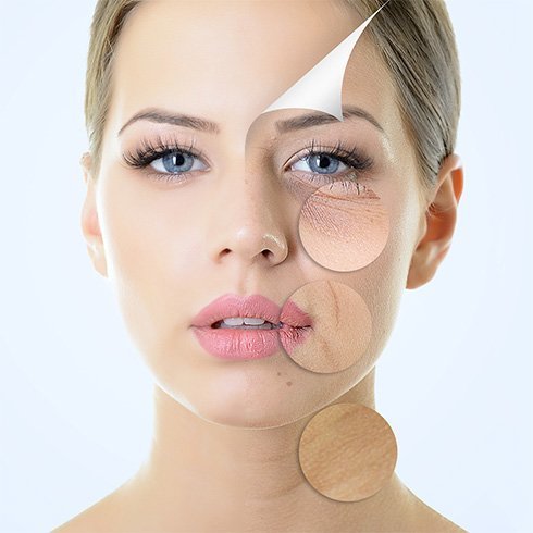 Anti aging skin