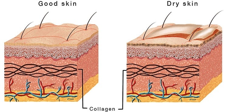 Can Glycerin Be Used For Dry Skin