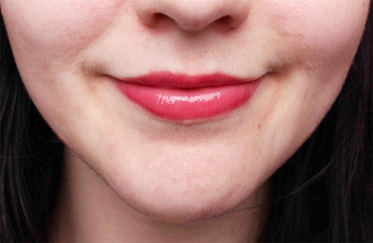 ways to reduce lip size