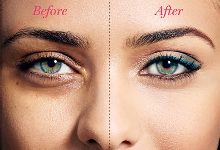 Concealers To Covering Dark Circles