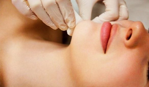 How To Remove Chin Hair