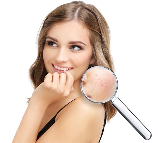 Rosacea Skin Treatment Tips