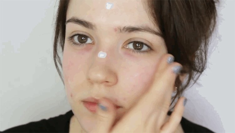 Rosacea Skin Treatments