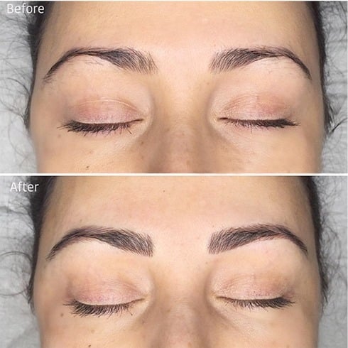 Microblading