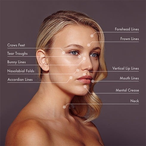 How To Prevent Crows Feet