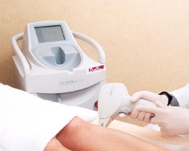 Best Laser Hair Removal Machines
