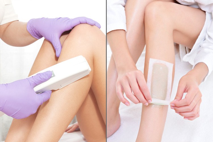 Laser Hair Treatment Vs Waxing