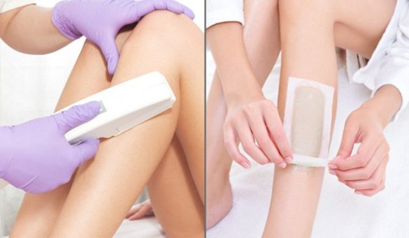 Laser Hair Treatment Vs Waxing