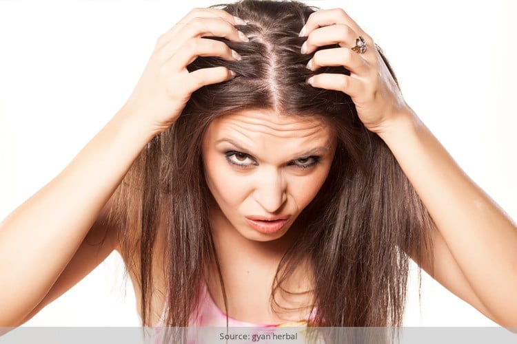 Home Remedies For Dandruff