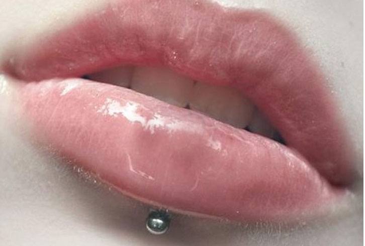 horizontal lower lip piercing