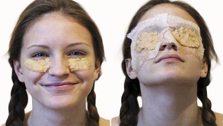 Potato Paste For Dark Circles
