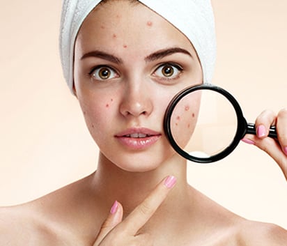 How To Cover Pimples Without Foundation