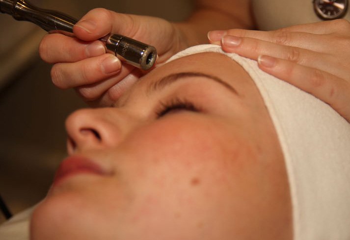 Dermabrasion scar removal