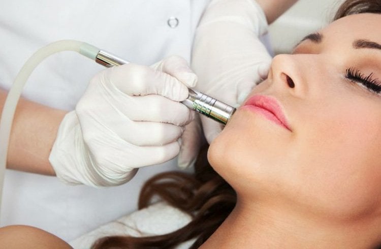 Dermabrasion