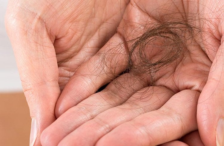 Hair homeopathy treatment