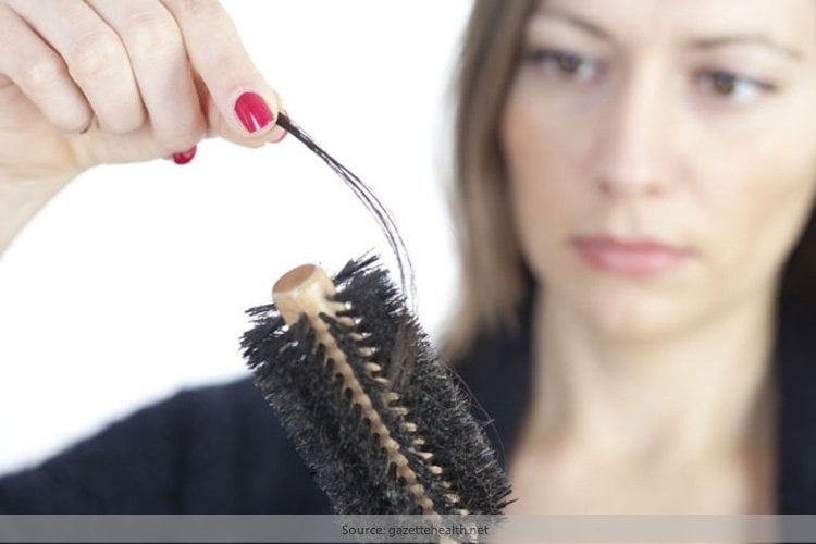 Homeopathy for hair loss