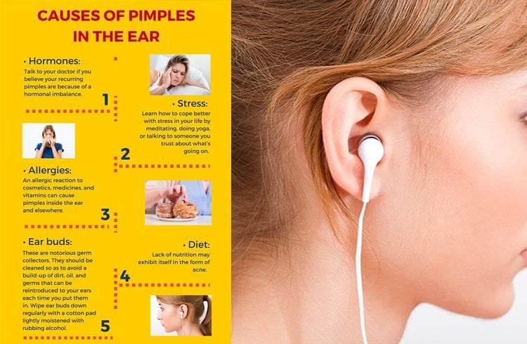 Causes of Pimples in the ear