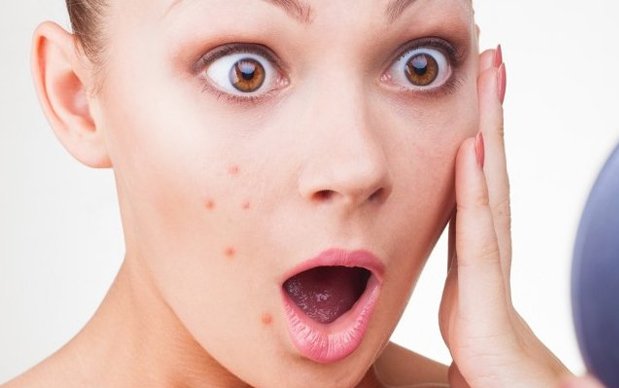 Moringa oil for Anti acne and anti pimple