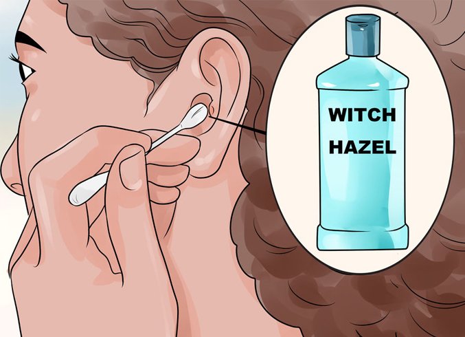 witch hazel for Get Rid Of Pimples