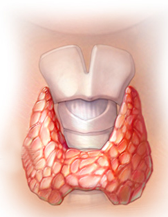 Hypothyroidism