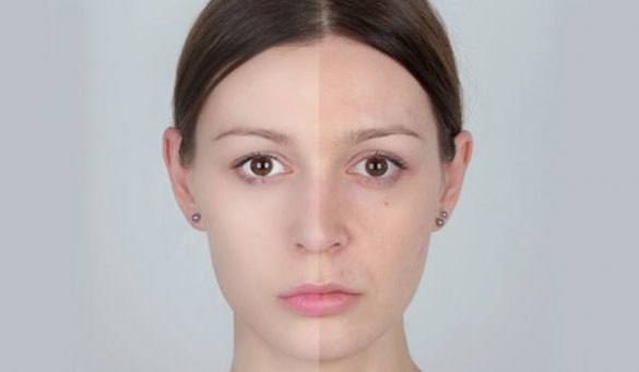 Camouflage Makeup Tips