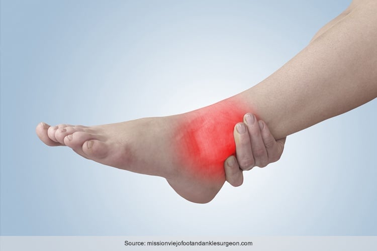 Foot Tendinitis