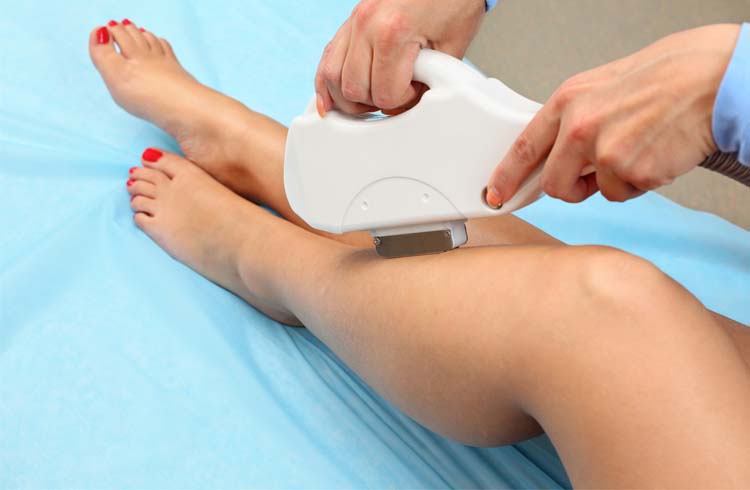 IPL Hair Removal For Body