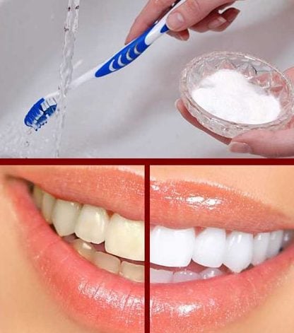Benefits Of Baking Soda For Tooth