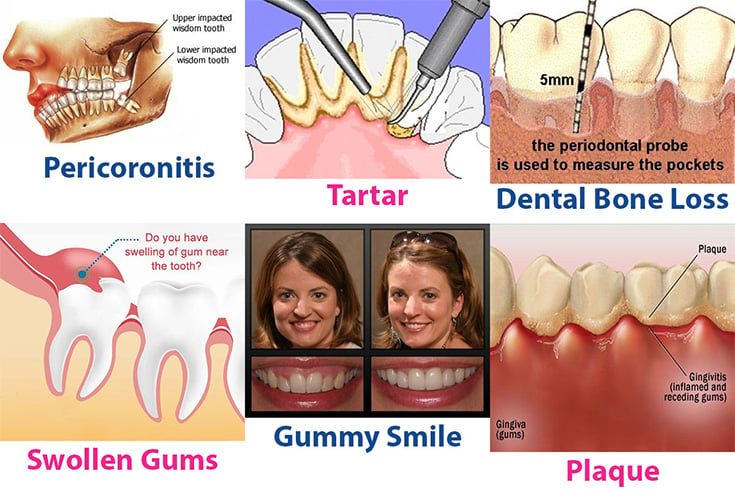 Dental Care Routine