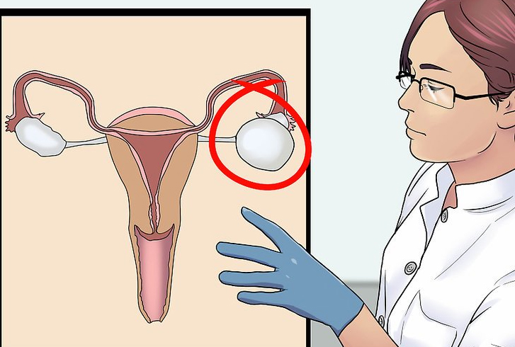 How To Identify If You Have a Cyst