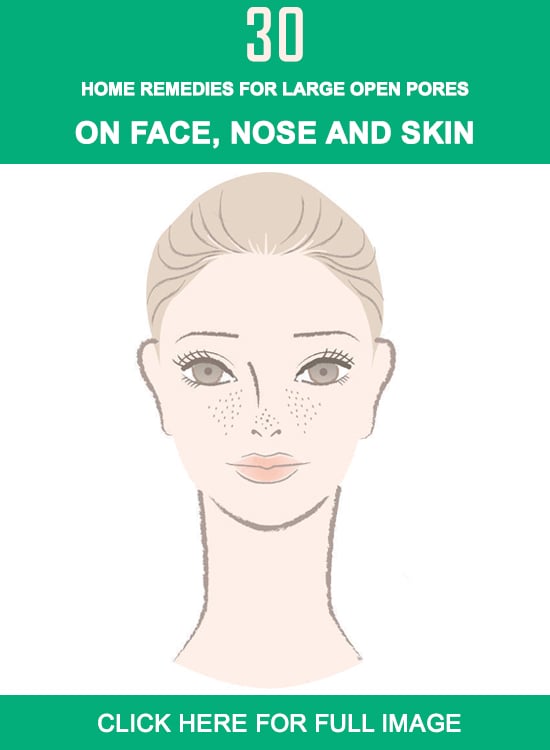 large open pores Infographics