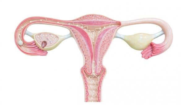 Problem With Ovarian Cysts