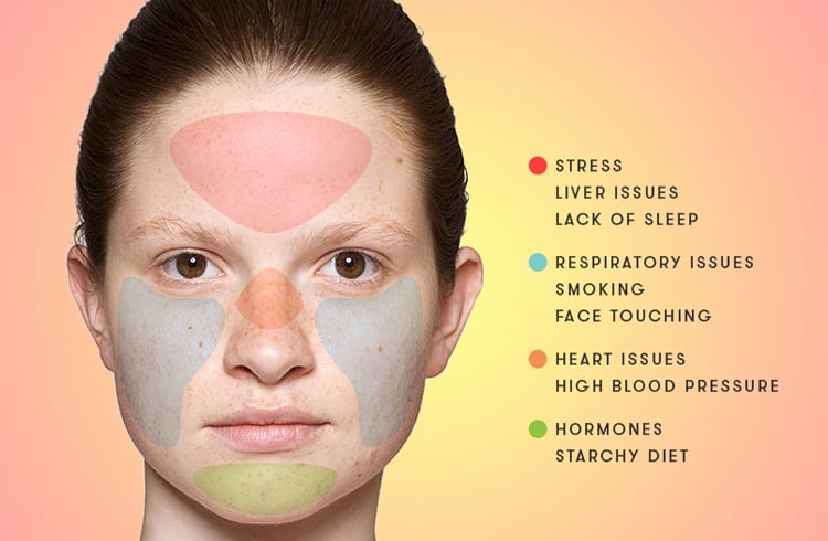 Acne Placement Chart