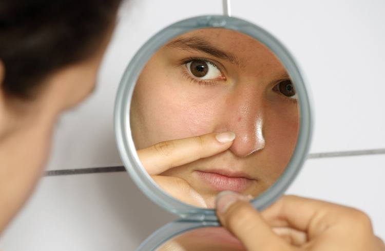 Acne on Nose