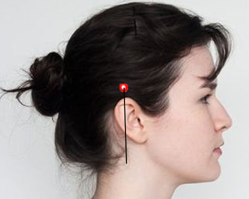 Pressure Points For Headache Relief: Temple Region Point