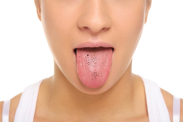 The color of the tongue will reveal your strengths and weaknesses, know the status of career and business.