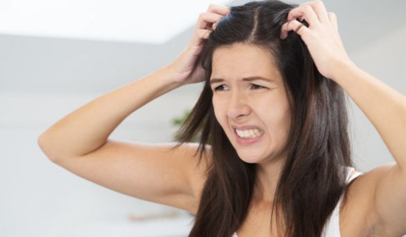 Home Remedies For Dry Scalp