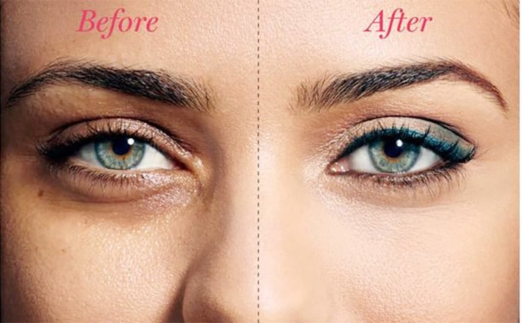 Triphla water to beat dark circles and puffy eyes Triphla water to beat dark circles and puffy eyes