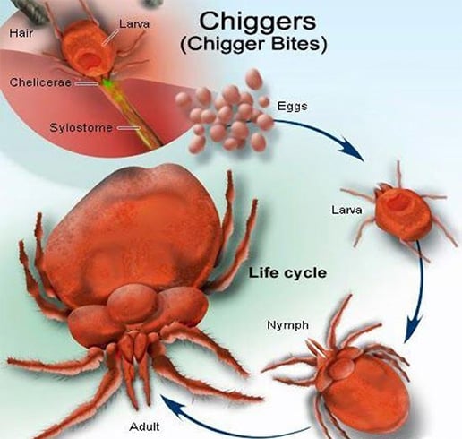 What are Chiggers