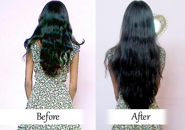 biotin and hair growth